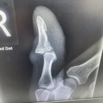 2025isliptimthumb_sm